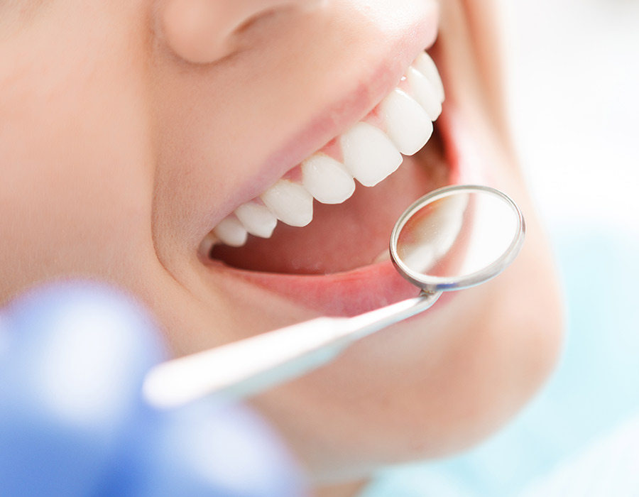 Blanqueamieto Dental Mollerussa