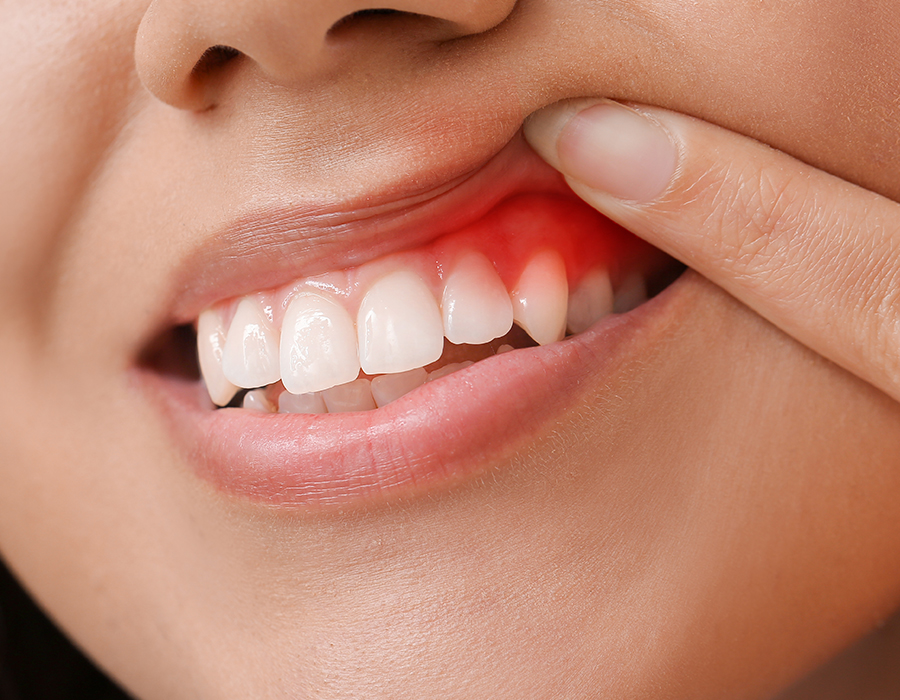 periodòncia-mollerussa