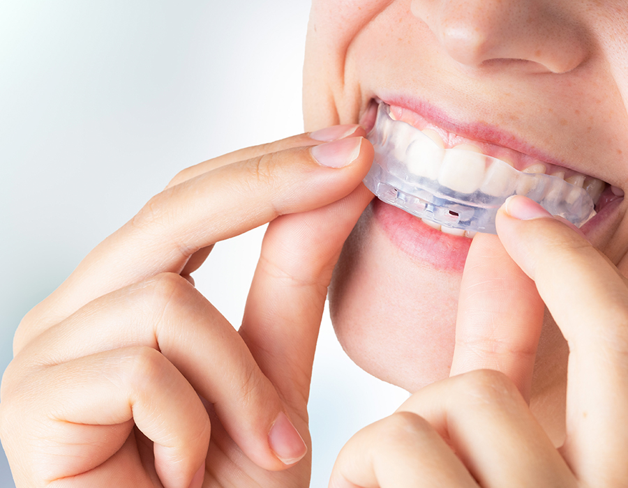 ¿Qué es el bruxismo?